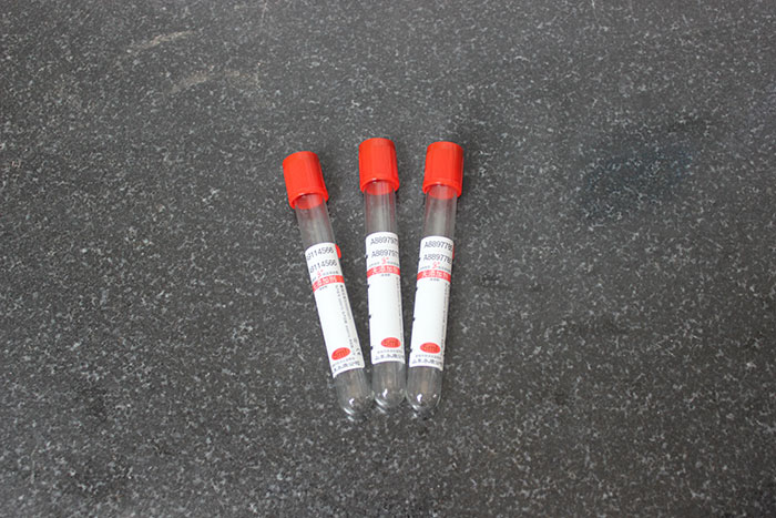 一次性使用病毒管廠家分享病毒管的使用位置